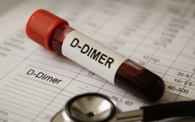 D-dimer – Jakie są normy i interpretacja wyników?